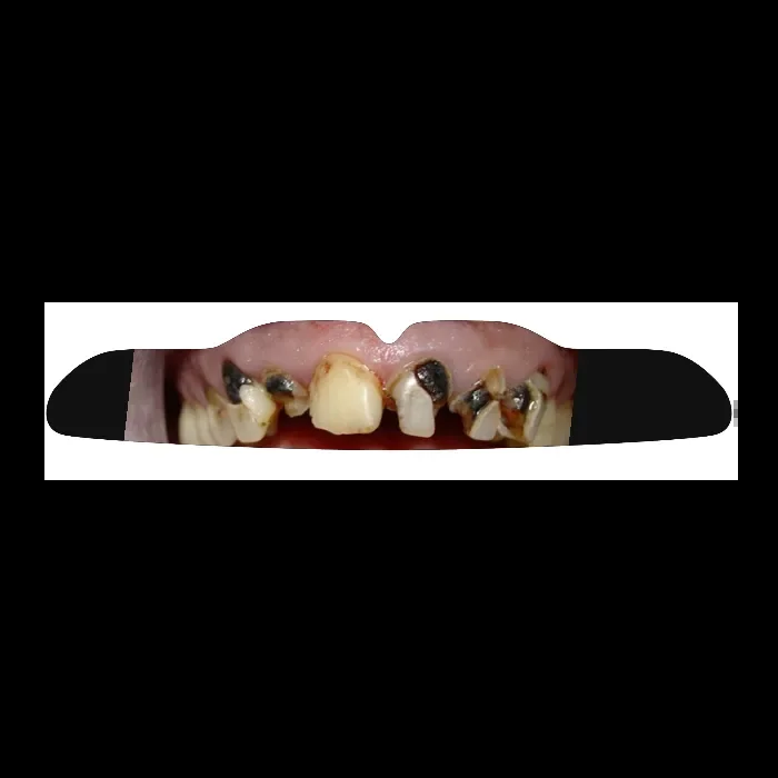 Selbst Designen – Maßgefertigter Mundschutz